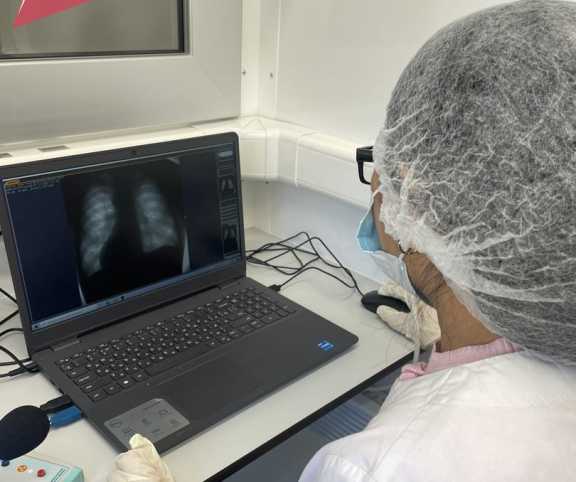 В Туве заболеваемость туберкулёзом увеличилась на 84,6 %
